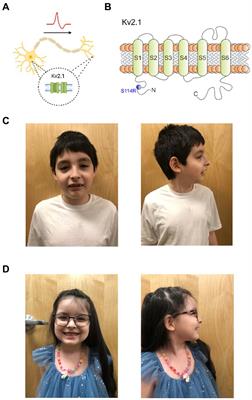 A novel autism-associated KCNB1 mutation dramatically slows Kv2.1 potassium channel activation, deactivation and inactivation